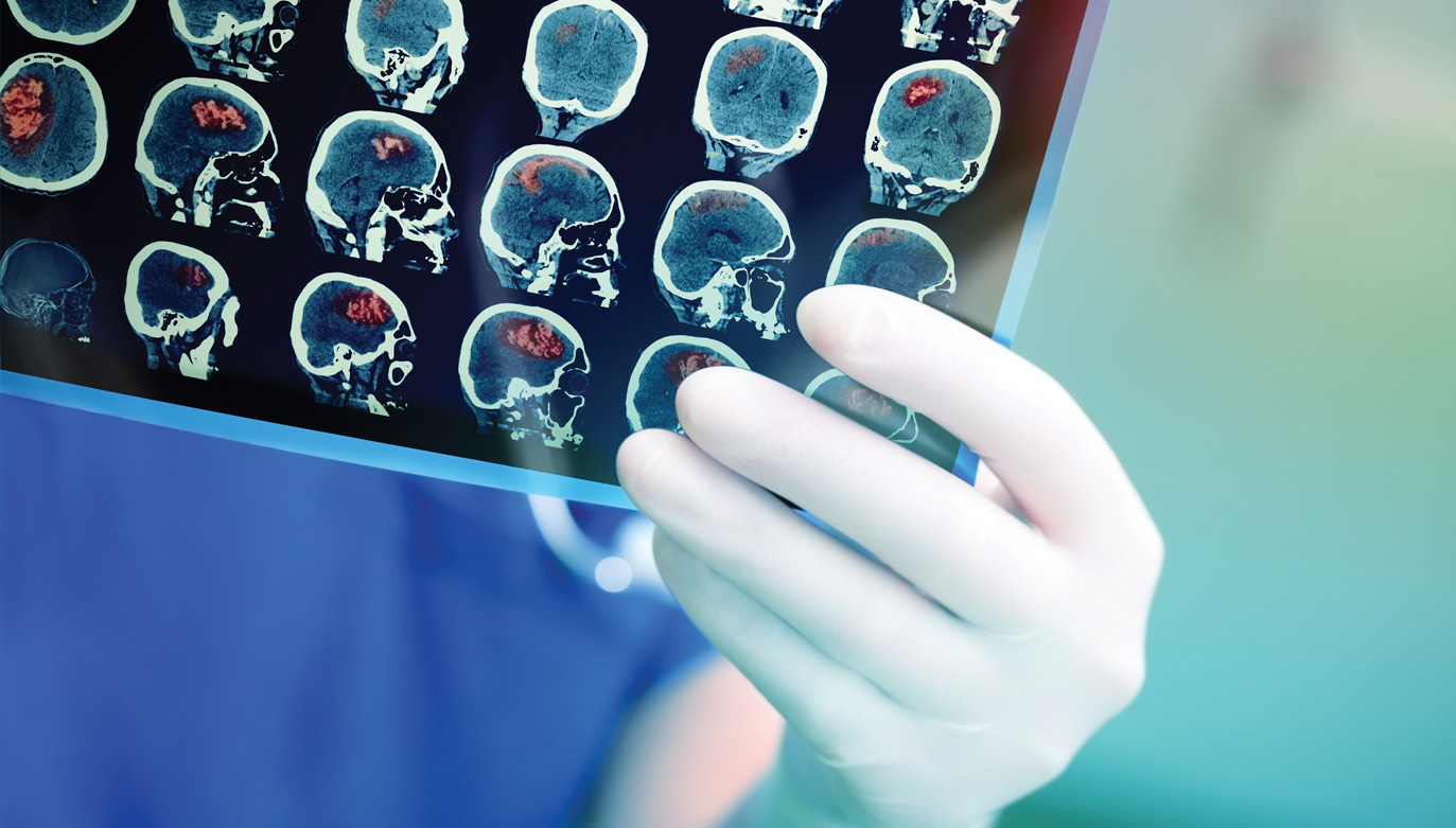 Perspectives A remarkable recovery from a severe stroke