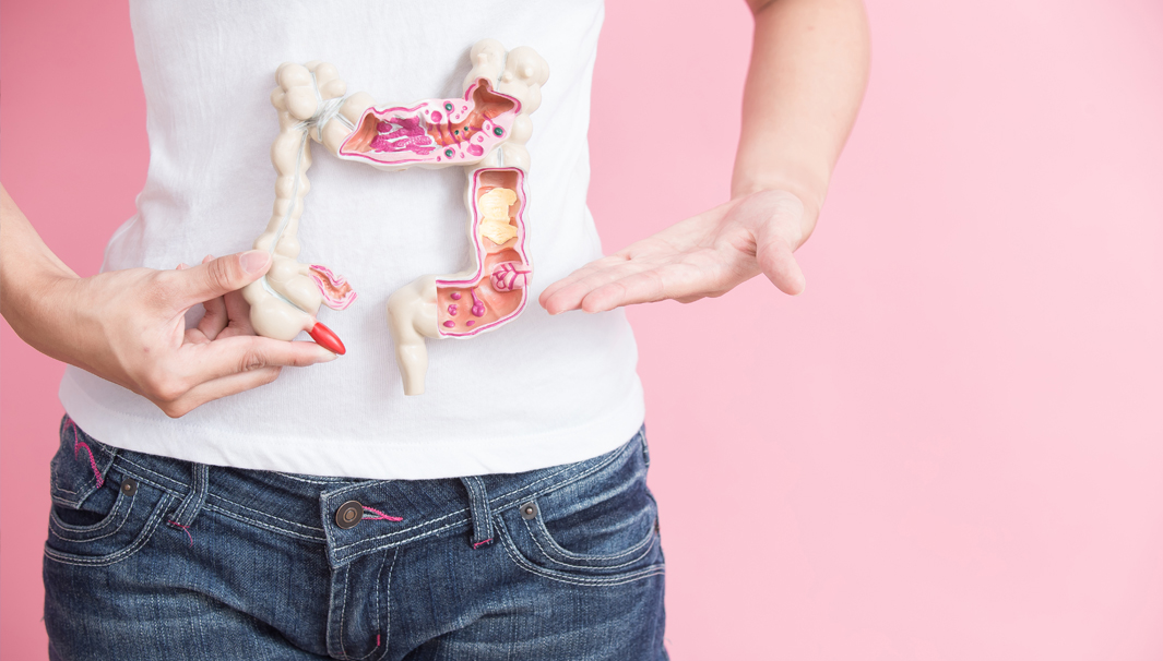 perspectives 2018 article Colorectal Cancer